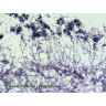 Набор микропрепаратов Bresser 50 шт., в кейсе 73766